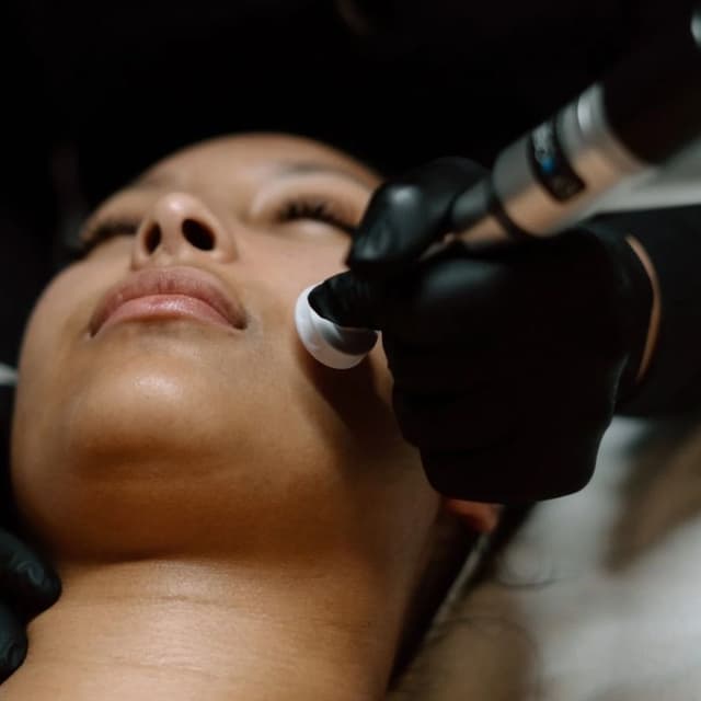 3 Treatments of Microchanneling at Heavenly Skin in Las Vegas, NV